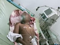 anak disabilitas korban penghakiman massa